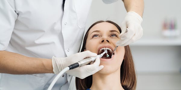 Dental Scaling & Root Planing Whitby